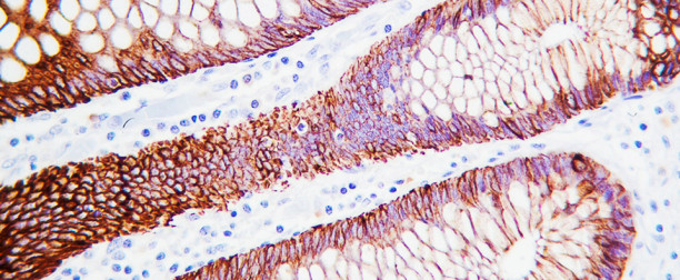 Inmunohistoquímica