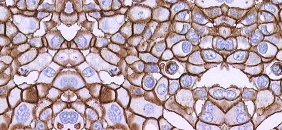 Inmunohistoquímica