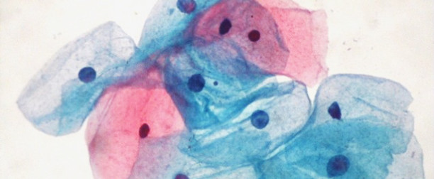 Citología en base líquida cervicovaginal y de otros especímenes