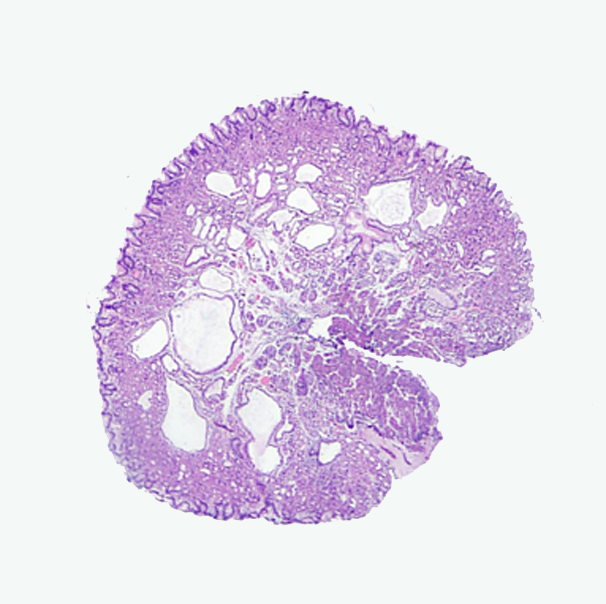 Histología convencional